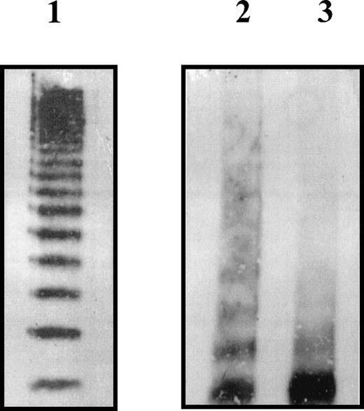 Fig. 5. Multimer analysis of rVWFR273W secreted by COS-7 cells. / The cells were transfected with the appropriate plasmid DNA then placed in serum-free medium 24 hours after transfection. Medium supernatants were harvested after an additional 48 hours. An appropriate volume of medium containing 1 mU of rVWF wild-type as determined by ELISA was analyzed on a nonreducing 2% SDS-agarose gel (lane 1). Ten milliunits of each rVWF as determined by ELISA was immunoprecipitated with rabbit antihuman VWF polyclonal antibody, then analyzed on a nonreducing 2% SDS-agarose gel (lane 2 wild-type rVWF, lane 3 rVWFR273W). Multimers were visualized using polyclonal rabbit antihuman VWF antibody and a secondary HRP-conjugated swine antirabbit IgG polyclonal antibody and enhanced chemiluminescence.