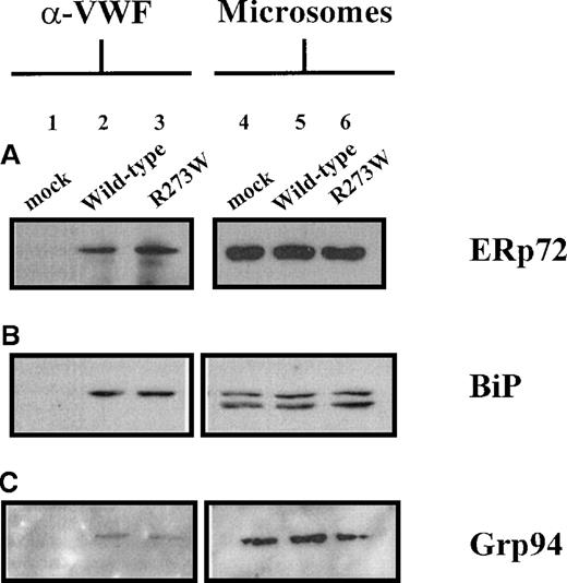 Fig. 6. Detection of ERp72, BiP, and Grp94 in anti-VWF immunoprecipitates of rVWFR273W from COS-7 cells. / COS-7 cells were transfected with the appropriate plasmid DNA. Seventy-two hours after transfection, lysates were prepared from the cells and immunoprecipitated with polyclonal rabbit antihuman antibody as detailed in the “Materials and methods” section. Immunoprecipitates from mock (lane 1), pSVHVWF1 (lane 2), and pSVVWFR273W (lane 3) transfected cells were separated by electrophoresis on 10% reducing SDS-polyacrylamide gels. Microsomes (2 μL per lane) purified from mock (lane 4), pSVHVWF1 (lane 5), and pSVVWFR273W (lane 6) transfected cells were included to provide positive detection of ERp72, BiP, and Grp94. ERp72 (A), BiP (B), and Grp94 (C) were detected by immunoblotting as detailed in the “Materials and methods” section. ERp72 (A) and Grp94 (C) immunoblots were exposed to film for 5 minutes, whereas BiP (B) immunoblots were exposed for 2 minutes.
