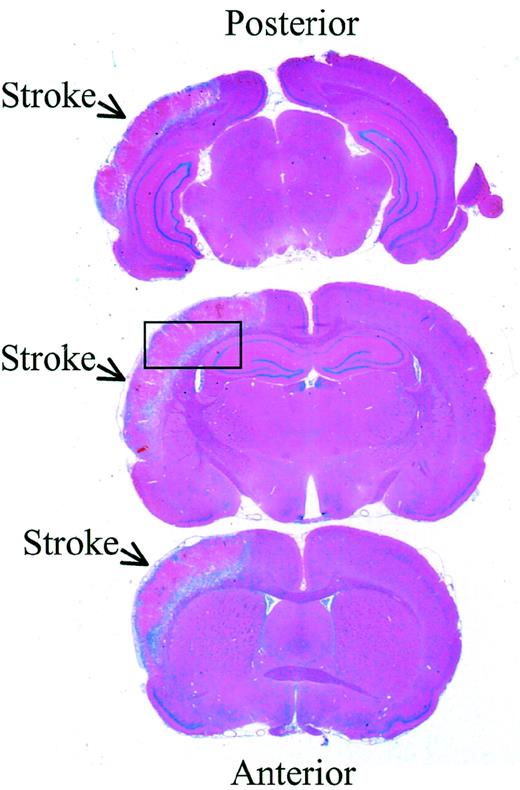 Fig. 1. Rat brain sections 72 hours after reperfusion. / . Hematoxylin-eosin stain of 3 representative sections from the same brain 72 hours after reperfusion. The infarcted area is indicated with arrows, and the box indicates the location where higher resolution analysis was performed (magnification × 5).