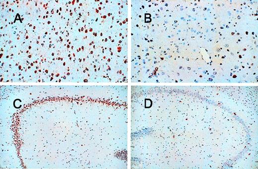 Fig. 2. Immunohistochemical staining of neuroserpin in brain 48 hours after reperfusion. / Panel A shows the area of penumbra, panel B shows a similar area of the cortex contralateral to the stroke and panels C and D show the hippocampus. Panels A and C are ipsilateral to the stroke and panels B and D are contralateral (magnification × 100 in A and B and × 40 in C and D).