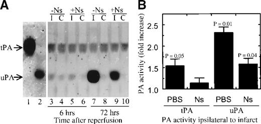 Fig. 4. SDS-PAGE zymography of brain extracts. / . (A) SDS-PAGE zymography of brain extracts. Lane 1 is human tPA, lane 2 is a rat kidney extract as a marker for rat uPA, lanes 3 through 6 are extracts of brain 6 hours after reperfusion, and lanes 7 through 10 are extracts 72 hours after reperfusion. Lanes 3 and 7 are ipsilateral to the infarct of PBS- treated animals, lanes 4 and 8 are contralateral to the infarct. Lanes 5 and 9 are ipsilateral to the infarct in neuroserpin-treated animals and lanes 6 and 10 are contralateral. (B) Quantitative image analysis of PA activity from SDS-PAGE zymography of brain extracts 6 hours following reperfusion. The results represent the average fold increase in either tPA or uPA activity ipsilateral to the stroke relative to normal baseline PA activities contralateral to the stroke. PBS and Ns represent animals treated with either PBS or neuroserpin, respectively, and n ≥ 3 for each condition tested.P ≤ .05 relative to the contralateral activity are shown, and errors represent SEM.