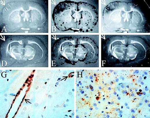 Fig. 5. In situ zymography and immunohistochemical staining of brain sections. / . In situ zymography in panels A-F; panels A and D are developed without plasminogen, and all other panels are developed with plasminogen. Panels C and F also contain anti-tPA antibodies. The white arrows indicate the area of the infarct (magnification × 3). (G) Immunohistochemical staining of tPA 6 hours after reperfusion. The black arrows indicate tPA-positive blood vessels. (H) Immunohistochemical staining of uPA in the area of penumbra 72 hours after reperfusion (magnification in G and H × 400).