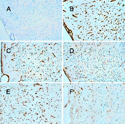 Fig. 6. Immunohistochemical staining of laminin. / . Panels A and B show normal cortex in an animal without stroke. Panel A was developed with anti-laminin but without pretreatment in vitro of the section with proteinase. Panel B is an adjacent section with in vitro proteinase treatment. Panels C to F are from stroked animals and developed with antilaminin and no proteinase treatment. Panels C and D are 10 minutes after reperfusion and panels E and F are 6 hours after reperfusion. Panels C and E represent PBS-treated and panels D and F neuroserpin-treated animals (magnification × 100).
