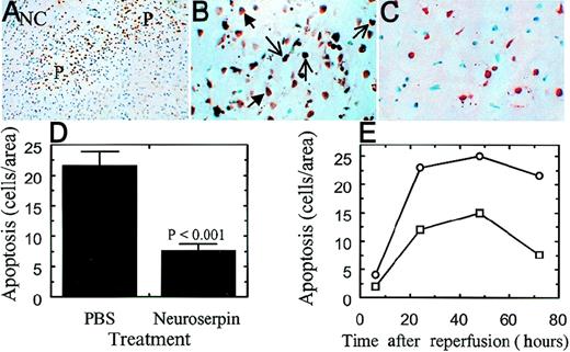 Fig. 7. Neuronal apoptosis within the ischemic penumbra. / . TUNEL staining ipsilateral of the infarct in PBS-treated (panels A and B) and neuroserpin-treated (panel C) animals. In panel A, NC indicates the necrotic core and P indicates the area of the penumbra. Panels B and C are high magnification images of the penumbra in control (panel B) and neuroserpin-treated animals (panel C). Examples of cells considered to be apoptotic for the purposes of quantification are indicated with the open arrows; cells considered as necrotic are indicated with the closed arrows. Magnification in panel A is × 40 and in panels B and C × 400. (D) Quantitative analysis of apoptosis in the area of penumbra 72 hours after reperfusion. Quantitation was performed as described in “Materials and methods” and only cells with apoptotic bodies present (panel B) were counted. Control represents animals injected with PBS (n = 6). Neuroserpin indicates animals injected with neuroserpin (n = 6).P values < .05 are shown, and errors represent SEM. (E) Quantitation of apoptosis was performed as in panel D at the times indicated, (○) PBS-treated animals, (□) neuroserpin-treated animals.