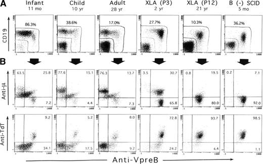 Fig. 1. Three-color immunofluorescence analysis of early B-lineage cells in BM based on intracellular VpreB expression. / BM cells from 3 controls of different ages, 2 XLA patients (P3 and P12), and 1 B-cell− SCID patient were fixed, permeabilized, and then stained with PE-labeled anti-VpreB and PC5-labeled anti-CD19 mAbs in combination with FITC-labeled anti-TdT mAb or antihuman μH chain Ab. The corresponding fluorochrome-labeled irrelevant mAbs or Abs were used as controls. The cells were gated for lymphoid cells by light scatter characteristics upon a flow cytometer and analyzed in the 3-color manner. (A) As demarcated in the figure, the combined use of anti-VpreB and anti-CD19 mAbs appeared to detect the presumably whole populations of B-lineage cells in BM. (B) The relation between VpreB and the μH chain or TdT expressed by BM-lineage cells, which were gated by a combined use of CD19 and VpreB expression. The number indicates the percentage of cells in each quadrant.