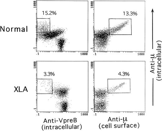 Fig. 2. Comparative expression analysis of the intracellular μH chain, intracellular VpreB, or cell surface μH chain by BM B-lineage cells. / The analysis compared a 5-year-old healthy child and an XLA patient (P3). The intracellular staining of BM cells for VpreB and the μH chain in combination with CD19 was performed as described in the legend of Figure 1. For the intracellular versus cell surface expression of the μH chain by BM B-lineage cells, viable BM cells were first treated with a PE-labeled antihuman μH chain Ab, fixed, permeabilized, and subsequently stained with a PC5-labeled anti-CD19 mAb and FITC-antihuman μH chain Ab. The open square denotes mature B cells that showed more intense expression of the μH chain than the presumed pre–B-cell population.