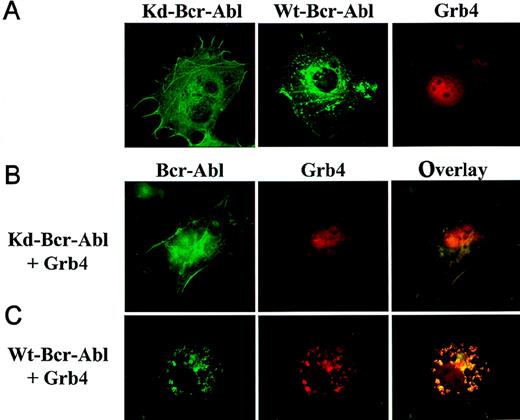 Fig. 7. Subcellular localization of Bcr-Abl and Grb4. / Cos7 cells transiently transfected with KD or WT Bcr-Abl-ECFP and Grb4-EYFP were visualized by means of fluorescence microscopy. KD Bcr-Abl and WT Bcr-Abl appear in green; Grb4 appears in red; and the colocalization of both proteins appears in yellow. (A) Cells expressing KD Bcr-Abl (left panel), WT Bcr-Abl (middle panel), or Grb4 (right panel). (B) (C) Cells coexpressing KD Bcr-Abl (panel B) or WT Bcr-Abl (panel C) together with Grb4. Left panels show distribution of KD Bcr-Abl and WT Bcr-Abl; middle panels show the distribution of Grb4 with either KD Bcr-Abl or WT Bcr-Abl; and the right panels show merged pictures of the localization of the 2 proteins
