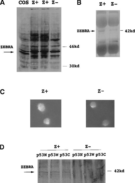 Fig. 1. Characterization of ZEBRA protein expression in Jurkat cell lines. / (A) A novel 43-kd protein (denoted ZEBRA) was detected by monoclonal antibody OT20A only in cells transfected with pSV2-neo-WZhet expression plasmid but not control cells transfected with plasmid pSV2-neo. Whole-cell lysates were generated in hypertonic RIPA buffer from COS cells and 2 independently derived Jurkat cell lines transfected with pSV2-neo-WZhet (Z+) and a Jurkat cell line expressing control plasmid (Z−). (B) A novel 43-kd protein was detected in proteins precipitated from Z+ cells but not Z− cells with polyclonal human antiserum (Figure 1A) and probed with OT20A. (C) Z+ and Z− cells were analyzed by immunofluorescence with rabbit polyclonal serum raised against purified ZEBRA protein. Staining was evident primarily in the cytoplasm of Z+ but not Z− cells. Z− and Z+ cells were analyzed by immunofluorescence with a rabbit polyclonal serum raised against purified ZEBRA protein. Staining was evident in the cytoplasm of Z+ but not Z− cells. (D) A novel 43-kd protein was detected with monoclonal antibody OT20A in proteins extracted from Z+ cells but not Z− cells in hypotonic RIPA buffer. Hypotonic lysis buffer was used to extract cytoplasmic proteins selectively from Z+ and Z− cells. Transient transfection of plasmid pC53-SCX3 encoding DNA binding mutant p53 denoted p53N, plasmid pC53-SN3 encoding wild-type p53 denoted p53W, and pCEP4-353 encoding carboxyl terminus deleted p53 denoted p53C did not alter expression of putative 43-kd ZEBRA protein. (E) Z+ Jurkat cells demonstrated increased adherence to plastic ware and an ameboid morphology in comparison to Z− cells grown under identical conditions.