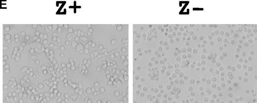 Fig. 1. Characterization of ZEBRA protein expression in Jurkat cell lines. / (A) A novel 43-kd protein (denoted ZEBRA) was detected by monoclonal antibody OT20A only in cells transfected with pSV2-neo-WZhet expression plasmid but not control cells transfected with plasmid pSV2-neo. Whole-cell lysates were generated in hypertonic RIPA buffer from COS cells and 2 independently derived Jurkat cell lines transfected with pSV2-neo-WZhet (Z+) and a Jurkat cell line expressing control plasmid (Z−). (B) A novel 43-kd protein was detected in proteins precipitated from Z+ cells but not Z− cells with polyclonal human antiserum (Figure 1A) and probed with OT20A. (C) Z+ and Z− cells were analyzed by immunofluorescence with rabbit polyclonal serum raised against purified ZEBRA protein. Staining was evident primarily in the cytoplasm of Z+ but not Z− cells. Z− and Z+ cells were analyzed by immunofluorescence with a rabbit polyclonal serum raised against purified ZEBRA protein. Staining was evident in the cytoplasm of Z+ but not Z− cells. (D) A novel 43-kd protein was detected with monoclonal antibody OT20A in proteins extracted from Z+ cells but not Z− cells in hypotonic RIPA buffer. Hypotonic lysis buffer was used to extract cytoplasmic proteins selectively from Z+ and Z− cells. Transient transfection of plasmid pC53-SCX3 encoding DNA binding mutant p53 denoted p53N, plasmid pC53-SN3 encoding wild-type p53 denoted p53W, and pCEP4-353 encoding carboxyl terminus deleted p53 denoted p53C did not alter expression of putative 43-kd ZEBRA protein. (E) Z+ Jurkat cells demonstrated increased adherence to plastic ware and an ameboid morphology in comparison to Z− cells grown under identical conditions.