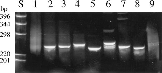Fig. 1. Ethidium bromide stained 6% polyacrylamid gel of representative TCR-β PCR products. / (S) DNA size marker. (1) Normal tonsillar tissue. (2) Lesional skin, CTCL (case 18). (3) Infiltrated lymph node, CTCL (case 18). (4) Peripheral T-cell lymphoma (case 29). (5) T-ALL (case 41). (6) Anaplastic large-cell lymphoma (case 58). (7) Intestinal T-cell lymphoma (case 53). (8) Cell line Hut102. (9) B-cell lymphoma. PCR products in lanes 1, 2, 8, and 9 were generated from DNA of frozen material, and those in lanes 3, 4, 5, 6, and 7, from DNA extracted from paraffin-embedded specimens.