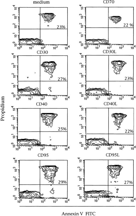 Fig. 5. Expression of Annexin V on purified GLs in a representative LDGL case (no 4) of 5 different patients tested. / Purified GLs were stimulated with rIL-2 (“Patients, materials, and methods”) for 72 hours, then cells were stained with FITC Annexin V and propidium iodide. The percentage of double positive cells ranged between 22% and 29%.