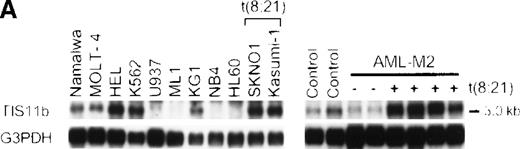 Fig. 5. Northern blotting analysis. / The TIS11b expression was examined in leukemia cell lines and in bone marrow cells from patients with t(8;21) AML-M2 and non-t(8;21) AML-M2 (A) and in normal human tissues (B). The membranes were hybridized with human TIS11b cDNA as a probe and rehybridized with human G3PDH or β-actin cDNA. The expression of TIS11b gene is increased in leukemic cells carrying the t(8;21) translocation.