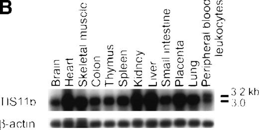 Fig. 5. Northern blotting analysis. / The TIS11b expression was examined in leukemia cell lines and in bone marrow cells from patients with t(8;21) AML-M2 and non-t(8;21) AML-M2 (A) and in normal human tissues (B). The membranes were hybridized with human TIS11b cDNA as a probe and rehybridized with human G3PDH or β-actin cDNA. The expression of TIS11b gene is increased in leukemic cells carrying the t(8;21) translocation.