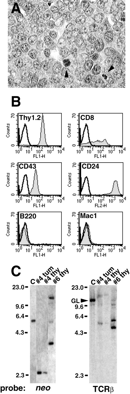 Fig. 3. The Bcr/Abl Y177F mutant preferentially induces T-lymphoid leukemia. / (A) Photomicrograph of section of abdominal tumor that developed 105 days after transplantation with p210 Y177F-transduced marrow (mouse 4, Table 1), hematoxylin–eosin stain, magnification 400×. Note the population of cells with large nuclei, prominent nucleoli, and moderate cytoplasm and the frequent mitotic and apoptotic figures (arrowheads). (B) Flow cytometric analysis of tumor cells from A, demonstrating uniform expression of Thy1.2, CD43, and CD24, variable expression of CD8, but lack of expression of the B-lymphoid marker B220 and myeloid marker Mac1. In each panel, expression of the indicated antigen is shown by the gray plot, whereas staining by an isotype control antibody is shown by the transparent plot. (C) Southern blot analysis of T-lymphoid tumor DNA. Left panel: genomic DNA from abdominal tumor (tum) and thymus (thy) from p210 Y177F mouse 4 demonstrates a single proviral integrant when hybridized with a radioactive probe from the retroviral neo gene, whereas thymus DNA from mouse 8 exhibits 2 different proviral clones. Control DNA (C) demonstrates the intensity of 1 proviral copy per diploid genome. Right panel: tumor and thymus DNA from both these mice show loss of the germline band of the T-cell receptor β chain locus (indicated by the GL arrowhead in the control sample) and clonal rearrangements of both alleles when hybridized with a TCRβ probe. Note the thymic lymphoma from mouse 8 shows 4 new bands, corresponding to distinct biallelic rearrangements in each of the 2 clones. Positions of DNA size markers (in kb) are indicated on the left.