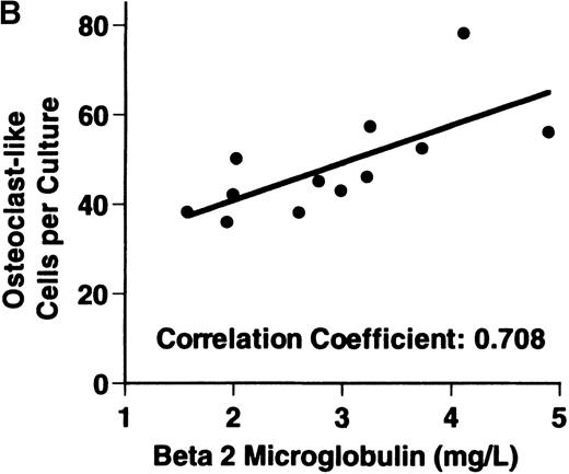Fig. 1. Stimulation of OCL formation. / (A) Effects of bone marrow plasma from controls and patients with MM on OCL formation in human marrow cultures. Bone marrow plasma and marrow cultures were processed as described in “Materials and methods.” Results represent the mean ± SEM for all assays done in quadruplicate. Bone marrow plasma from patients with MM significantly stimulated the formation of OCLs in human bone marrow cultures when compared to controls (47.75 ± 6 versus 28.25 ± 5 multinucleated cells/105 cells plated, respectively,P < .05). (B) Correlation of OCL formation induced by marrow plasma from 12 patients with MM and their respective levels of β2 microglobulin. Bone marrow plasma and marrow cultures were processed as described in “Materials and methods.” The relative levels of OSF positively correlated with β2microglobulin levels in patients with MM with normal renal function (correlation coefficient = 0.708).