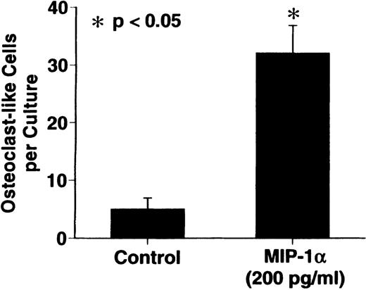 Fig. 3. Effects of recombinant human MIP-1 on OCL formation in human marrow cultures. / . Human marrow cultures were processed as described in “Materials and methods.” MIP1-α significantly stimulated OCL formation in human bone marrow cultures when tested at concentrations of 100 to 200 pg/mL. Results represent the mean ± SEM of quadruplicate determinations for a typical experiment. A similar pattern of results was seen in 4 independent experiments.