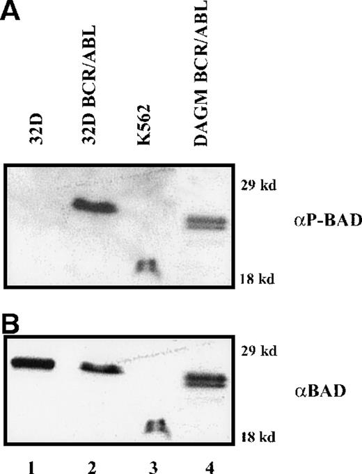 Fig. 1. Phosphorylation of BAD in BCR/ABL-expressing cells. / Western blot shows expression of phosphorylated BAD (A) detected by a mix of antiphosphoserine 112 and 136 BAD antibodies, in IL-3–(32D, 32DBCR/ABL, DAGM BCR/ABL) or serum-(K562) deprived cells (8 and 12 hours, respectively); (B) the same blot was hybridized with an anti-BAD (K17, Santa Cruz, Inc) antibody.