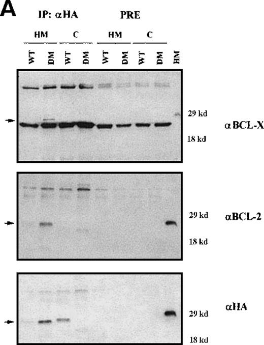 Fig. 8. Expression levels of proteins and mRNA. / (A) Expression levels of BCL-2 and BCL-XLproteins in total extracts from clones of WT BAD- and DM BAD-infected BCR/ABL-expressing cells. Cell extracts were blotted with anti-BCL-2, anti-BCL-X, and anti-HA antibodies. Levels of HSP90 were analyzed as control of equal loading. Lane C indicates extracts from vector-infected BCR/ABL-expressing cells. (B) Analysis of bcl-2and bcl-x mRNA levels in clones of WT BAD- and DM BAD-infected BCR/ABL-expressing cells. Northern blots were hybridized with probes for bcl-2 and bcl-x. GAPDH mRNA levels (bottom panel) were also measured as control of loading.