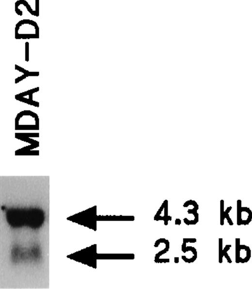 Fig. 1. Northern blot analysis of CXCR2 expression in MDAY-D2 cells.