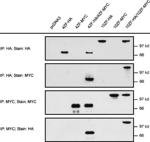 Fig. 2. Self-association of ZNF198–FGFR1. / The 4 and 10 zinc finger ZNF198–FGFR1 isoforms were tagged with HA or MYC, expressed individually (lanes 2, 3, 5, and 6) or coexpressed (lanes 4 and 7) in 293 T cells, then immunoprecipitated and detected with anti-HA or anti-MYC. Empty pcDNA 3 vector was also transfected as a negative control. Both 4 and 10 zinc finger ZNF198–FGFR1 isoforms self-associate (lanes 4 and 7).