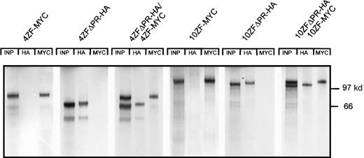 Fig. 4. Deletion of the ZNF198 proline-rich region abolishes ZNF198–FGFR1 self-association. / 4 and 10 zinc finger ZNF198–FGFR1 isoforms that were full-length (4ZF-MYC and 10ZF-MYC, respectively) or deleted for the ZNF198 proline-rich region (4ZFΔPR-HA and 10ZFΔPR-HA, respectively) were expressed individually (columns 1, 2, 4, and 5) or coexpressed (columns 3 and 6), and then analyzed directly (INP) or immunoprecipitated with anti-HA or anti-MYC.