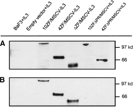Fig. 6. ZNF198–FGFR1 expression and tyrosine autophosphorylation. / (A) Verification of Ba/F3 cell ZNF198–FGFR1 expression by Western blot analysis using an anti-FGFR1 antibody. (B) Oligomeric ZNF198–FGFR1 fusion proteins (4ZF/MSCV, 10ZF/MSCV, and ΔZF/MSCV) are tyrosyl phosphorylated, whereas ZNF198–FGFR1 fusions lacking the ZNF198 proline-rich region (4ZFΔPR/MSCV and 10ZFΔPR/MSCV) did not self-associate and were not tyrosyl phosphorylated.