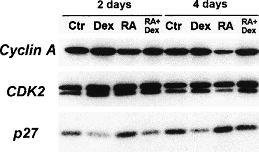 Fig. 4. Immunoblot analysis of cyclin A, CDK2, and p27Kip-1 proteins in DAA-3 cells. / The cells were cultured for 2 and 4 days in SFM (center) alone or supplemented with either 10−6 mol/L 13-cis-RA (RA), 10−6 mol/L Dex, or a combination of these 2 drugs. For CDK2, faster migrating bands represent the phosphorylated active forms of this kinase. Dex induced a decrease in the amount of p27Kip-1 protein and a markedly contrasted p27Kip-1 up-regulation induced by RA. Dex also increased the levels of the phosphorylated active forms of CDK2 and antagonized an RA-induced decrease of CDK2 phosphorylation. Similar findings were obtained with the HDE-14 LCLs (not shown). We subjected 50 μg extract proteins from each lysate to immunoblot analysis. The cellular proteins visualized in each panel are indicated to the left.