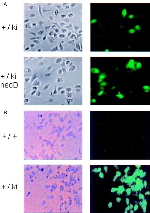 Fig. 3. Micrographs of cultured peritoneal macrophages and bone marrow–derived colonies. / Left image, bright field; right image, fluorescence. (A) Peritoneal blood macrophages from heterozygous lys-EGFP not neo-deleted (+/ki) and neo-deleed (+/ki=neo D) mice 1 day after seeding in culture. (B) Macrophage colonies. Bone marrow cells prepared from a wild type (+/+) and from a lys-EGFP+/ki mouse were seeded in plasma clot cultures containing M-CSF. After 7 days, the plasma clots were partially dehydrated, and fluorescence pictures were taken of the colonies (right panels). Subsequently, the clots were fixed in methanol and stained with Diff-Quik, and the identical colonies were photographed under bright field (left panels).