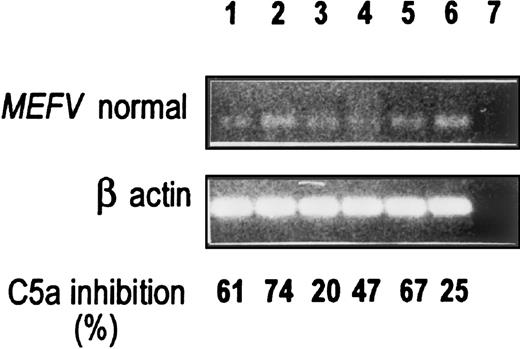 Fig. 3. MEFV expression and C5a-inhibitor activity in normal peritoneal and synovial fibroblast cell cultures. / RT-PCR was performed with the use of the normal primers as described in Figure 1. C5a-inhibitor activity is shown at the bottom and was assayed by the MPO release assay as described in “Materials and methods.” A490 readings for control C5a-induced MPO release were 0.39 to 0.62. Lanes 1 to 5: Five different normal peritoneal fibroblasts (lanes 1, 3, 4, and 5, third and fourth passage; lane 2, second passage). Lane 6: Normal synovial fibroblasts, third passage. Lane 7: H2O.