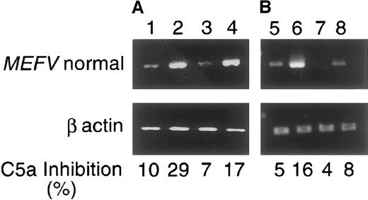 Fig. 4. MEFV expression and C5a-inhibitor activity in normal skin and peritoneal fibroblast cell cultures induced with (A) IL-1β or (B) PMA. / RT-PCR was performed with the use of primers from exons 9 and 10 as described in “Materials and methods.” The size of the amplifiedMEFV fragment was 350 bp. C5a-inhibitor activity is shown at the bottom (see legend to Figure 3). Lanes 1-4: Cultures induced with 10 ng/mL IL-1β for 24 hours. Lanes 5-8: Cultures induced with PMA 100 nmol/L for 1 hour. Lane 1: Normal peritoneal fibroblasts. Lane 2: IL-1β–induced peritoneal fibroblasts. Lane 3: Normal skin fibroblasts. Lane 4: IL-1β–induced skin fibroblasts. Lane 5: Normal peritoneal fibroblasts. Lane 6: PMA-induced peritoneal fibroblasts. Lane 7: Normal skin fibroblasts. Lane 8: PMA-induced skin fibroblasts. The experiments were performed with cells from passage 6 and above. A representative experiment is shown in the figure.