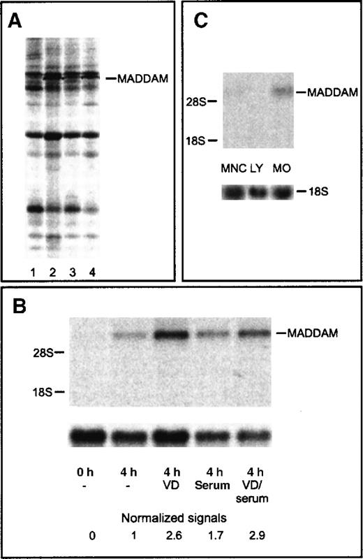 Fig. 1. Differential display and Northern blot analysis of the MADDAM cDNA fragment. / Differential Display (DD) of cDNA of different short-term cultured MOs (A) and Northern blot analysis of MADDAM expression in human blood MOs, lymphocytes, and mononuclear cells (B,C). MOs were stimulated for 4 hours with 1,25(OH)2VD3in the absence (2) or presence (4) of serum. Control cells were cultured for 4 hours without 1,25(OH)2VD3 under serum-free conditions (1) or with serum (3). RNA was extracted and cDNA amplified with the primer set AP1 and T12MC. The cDNA fragment of MADDAM is marked (A). Total RNA of freshly isolated MOs (0 hours) or MOs cultured for 4 hours in the presence (serum) or absence (−) of serum with or without 10−7 mol/L 1,25(OH)2VD3 (VD) was isolated and Northern blot was performed according to “Materals and methods.” As a control for RNA loading, the membrane was rehybridized with an 18S rRNA-oligonucleotide and MADDAM signals were normalized to the corresponding 18S signals (B). In (C), the mRNA expression of MADDAM in mononuclear cells (MNCs), an elutriated lymphocyte fraction (LY), and elutriated MOs, stimulated for 4 hours with 10−7 mol/L VD under serum-free conditions, was compared by Northern blot analysis.