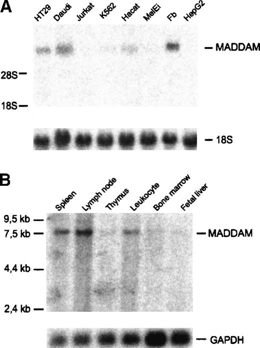 Fig. 5. Expression of MADDAM mRNA in human cell lines and tissues. / (A) Human cell lines; (B) tissues. The commercially available tissue blot contained poly(A)+RNA of the indicated tissues (Multiple tissue Northern blot II; Clontech). Northern blot analysis was performed as described “Materials and methods.” As a control for RNA loading, membranes were rehybridized with an 18S rRNA- (A) or GAPDH-oligonucleotide (B).