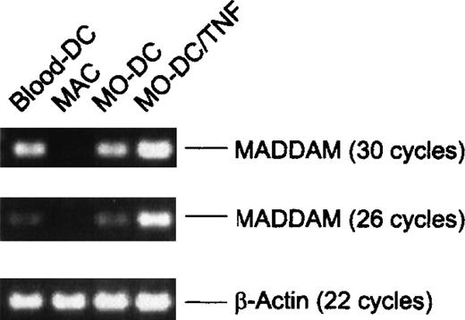 Fig. 7. Expression of MADDAM in freshly isolated blood-DCs detected by RT-PCR. / For comparison MADDAM expression in MO-derived MACs and DCs generated from MOs with or without TNF-α is shown. As a control β-actin was amplified. No signals were detected by amplification of the corresponding amount of RNA omitting the RT step.