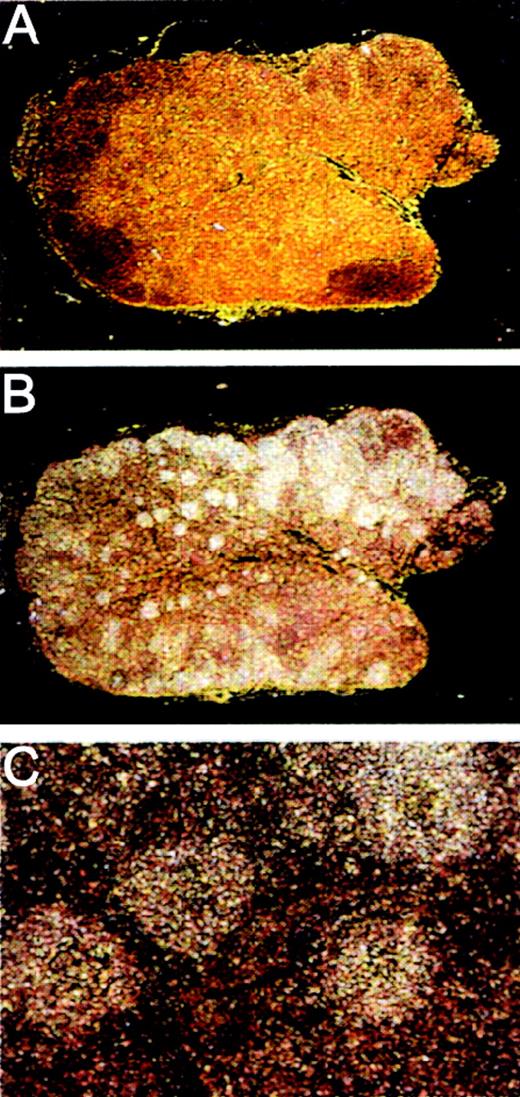 Fig. 6. Localization of MADDAM mRNA in human lymph nodes by in situ hybridization. / Human lymph node paraffin embedded series sections were generated and hybridized with 33P-labeled sense (A) or antisense (B,C) probes of MADDAM as described in “Materials and methods.” In A and B, a 10 × magnification, in C a 100 × magnification is shown.