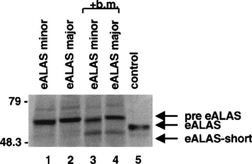 Fig. 5. Proteolytic cleavage of in vitro translated eALAS. / In vitro translated eALAS proteins representing the 2 natural splice variants pre–ALAS-E minor and pre–ALAS-E major were incubated alone (lanes 1 and 2) or with a bone marrow (b.m.) mitochondrial lysate (lanes 3 and 4) for 60 minutes at 27°C before gel separation. A labeled blood lysate was included as a control (lane 5).