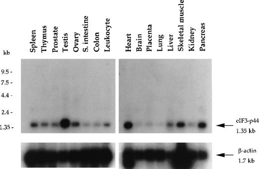 Fig. 2. Northern blot analysis of eIF3-p44 in various human tissues. / Blot filters containing 2 μg poly (A)+RNA were hybridized with a 32P-labeled cDNA fragment (0.9 kb) encoding amino acid residues 54-321 of human eIF3-p44. The same blot was stripped and reprobed with β-actin to quantify RNA loading. eIF3-p44 mRNA is abundantly expressed in human tissues including testis, skeletal muscle, pancreas, and heart.