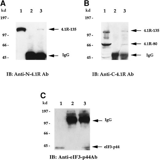 Fig. 5. 4.1R interacts with eIF3-p44 in vivo. / Cell lysates prepared from Molt-4 cells were immunoprecipitated with preimmune serum (lane 2) or anti-eIF3-p44 antibody (lane 3). Bound protein complexes were analyzed by immunoblotting with antibodies against the N-terminal portion of 135-kd 4.1R (A, anti-N-4.1R) or against the C-terminal 22/24-kd domain of 4.1R (B, anti-C-4.1R antibody). Lane 1 was loaded with Molt-4 cell lysates (10 μg) and immunoblotted with anti-N-4.1R (A), anti-C-4.1R (B), or anti-eIF3-p44 antibody (C). The 135-kd 4.1R isoform was specifically detected by anti-N-4.1R antibody (A, lane 3), whereas 2 alternative splicing isoforms of 4.1R (135-kd and 80-kd) were recognized by anti-C-4.1R antibody (B, lane 3). (C) Reverse immunoprecipitation. Cell lysates prepared from Molt-4 cells were immunoprecipitated with preimmune serum (lane 2) or anti-C-4.1R antibody (lane 3) and analyzed by immunoblotting with anti-eIF3-p44 antibody. Lane 1 represents a positive control in which Molt-4 cell extracts were immunoblotted with anti-eIF3-p44 antibody. Samples were dissolved in SDS sample buffer containing β-mercaptoethanol (A, B) or lacking β-mercaptoethanol (C, lanes 2 and 3).