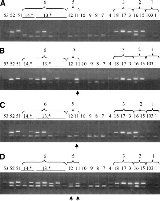 Fig. 3. Microchimerism in peripheral blood and CD34+ cells in a patient (patient 9) surveyed before and 3 months after orthotopic liver transplantation as detected by nested SSP-PCR for the HLA-DRB gene. / Donor-specific bands are indicated by an arrow. 14.* and 13.* indicate different DRB subtypes. (A) DNA sample of patient 9 (DR215 and DR3) before transplantation, used to determine the patient's chimeric state before orthotopic liver transplantation. DR17 and DR18 are both serologic splits of DR3 and they have a strong sequence homology. This causes a cross-reactivity in the nested SSP-PCR assay. DR51 is the product of the DRB5 gene; DR52 is the product of the DRB3 gene. These genes are in linkage with DR2 and DR3, respectively. Unspecific additional bands are DR13.*. (B) DNA mix containing the same sample as in panel A in 1:1 dilution with an original DNA of patient 9's liver donor (DR511). DR11 and DR12 are both serologic splits of DR5, and they have a strong sequence homology. This may cause a cross-reactivity in the nested PCR-SSP assay. (C) DNA from peripheral blood from patient 9 at 3 months after orthotopic liver transplantation. The recipient-specific band is 11, whereas the band in 103 is not specific for this donor/recipient combination. (D) DNA from bone marrow–derived CD34+ cells. Bands specific for the recipient are 11 and 12. No further bands can be detected.