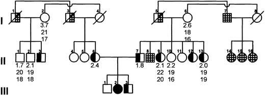 Fig. 2. Pedigree of the Norwegian family with congenital afibrinogenemia showing the consanguineous lineage of both parents. / Coagulation parameters shown below the symbols are, in order from the top, functional fibrinogen (mg/mL), thrombin clotting times, and reptilase clotting times. Deceased individuals are crossed by a diagonal line. Hatched symbols denote individuals who were not investigated. Deceased individuals I:1, I:3, and I:5 are presumed carriers (half-hatched symbols) because of the normal coagulation values for individuals I:2 and I:6. Open, half-filled, and filled symbols denote genotypically normal, heterozygous, and homozygous individuals, respectively, on the basis of the BsrDI assay.