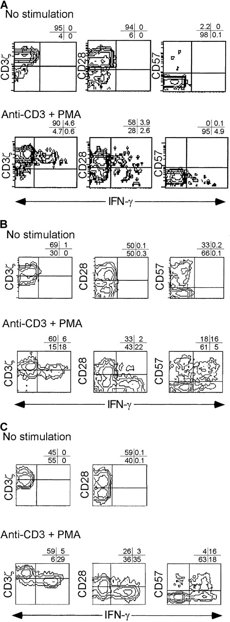 Fig. 7. IFN-γ is produced primarily by CD3ζ− CD28− CD8 T cells in subjects with recent viral infection. / PBMC from a normal donor (A) and from early (day 11) (B) and convalescent (day 100) (C) samples from subject AI-2 were activated with CD3/PMA or nothing, cultured in the presence of Brefeldin A overnight, and stained for CD8, phenotypic markers, and permeabilized and stained for IFN-γ. Unstimulated cells did not produce IFN-γ. Similar results were found with samples from subject AI-1 (data not shown). Contour plots were obtained from analysis of gated CD8-Cy5 bright lymphocytes.