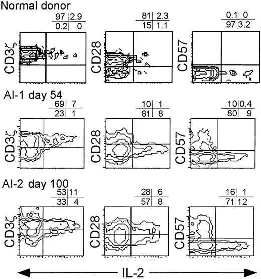 Fig. 8. IL-2 is produced by CD3ζ+ CD57− CD8+ T cells. / Normal donor PBMC and convalescent samples from donors AI-1 (day 54) and AI-2 (day 100) were activated overnight with anti-CD3 and PMA in the presence of Brefeldin A before staining for intracellular IL-2. Each sample was analyzed for cytokine production by gated CD8+ lymphocytes. Cytokine production without T-cell activation was less than 1% in all samples (data not shown).