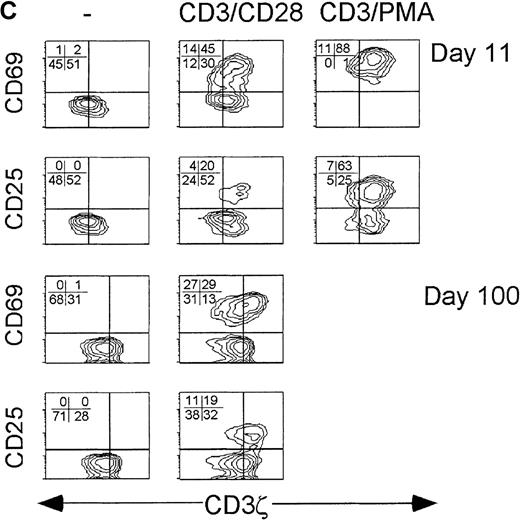 Fig. 4. CD3ζ− CD8 T cells are not activated by CD3ε/CD28 cross-linking to express the high-affinity IL-2 receptor. / Cell surface expression of the early activation markers CD69 and CD25 was measured on gated CD8 T cells after overnight culture without activation (left) or with activation by either low concentration anti-CD3ε and anti-CD28 (middle) or with high concentration anti-CD3ε and PMA (right). Samples shown were obtained from (A) a normal donor, (B) subject AI-1 on day 19 and day 54, and (C) subject AI-2 on day 11 and day 100. The level of cell surface expression of CD69 in the induced patient samples was also somewhat reduced in the CD3ζ− down-modulated population.