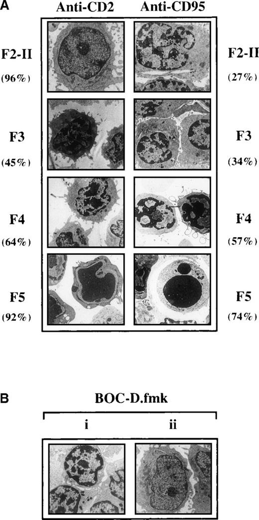Fig. 3. Ultrastructural changes occurring in the fractionated cell populations recovered 2 hours after apoptotic induction. / (A) Sizeable proportions of activated T cells sedimenting in the F3 and F4 fractions of Percoll gradients after CD2 signaling display partial chromatin condensation. F2-I cells were exposed for 2 hours to anti-CD2, fractionated on density Percoll gradients, and examined by electron microscopy. Values inside the brackets are the percentages of cells displaying the same morphology as that represented in the pictures. (Bi) In the CD2 system, the presence of BOC-D.fmk (50 μmol/L) during apoptotic induction does not prevent the appearance of F5 cells with partial chromatin condensation, contrasting with the strong condensation seen in F5 cells generated in the absence of caspase inhibitor. (Bii) Cells treated with anti-CD95 in the presence of BOC-D.fmk retain a normal nuclear morphology and are still recovered in the low buoyant density fraction of Percoll gradients (at the level of F2-II).