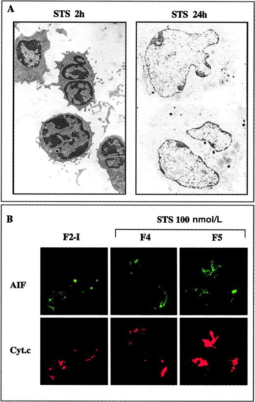 Fig. 8. Reversibility of the morphologic alterations and of mitochondrial AIF release induced at low apoptotic insult. / (A) F2-I cells that have been treated with 100 nmol/L staurosporine (STS) for 2 hours were washed and cultured for 24 hours in IL-2-containing medium. The electron micrographs show that the shrunken cells with partially condensed chromatin generated after 2 hours of apoptotic induction recover within 24 hours a normal aspect provided staurosporine is removed. (B) Confocal microscopy analysis showing that AIF tends to recover a punctated mitochondrial localization 24 hours after the removal of staurosporine (compare with Figure 7C).
