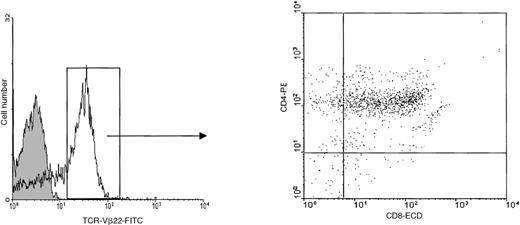 Fig. 1. Expression of TCR-Vβ22 on fresh circulating tumor cells. / We performed 3-color flow cytometric analysis using FITC-conjugated anti–TCR-Vβ22, anti–CD8α-ECD, and anti–CD4-PE mAbs.