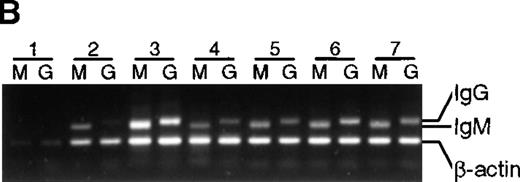 Fig. 5. Presence of IgM and IgG mRNA in 14-day B-cell cultures of BMT recipients and healthy subjects. / cDNA from B-cell cultures from 9 recipients and 7 healthy subjects was amplified with the use of 5′ primers specific for VH3 and 3′ primers specific for either IgM or IgG. Results are representative of analysis of triplicate cultures. As an internal control, β-actin mRNA was used. Lanes M were amplified with the use of Cμ primers, lanes G with the use of Cγ primers. (A) BMT recipients. (B) Healthy subjects.