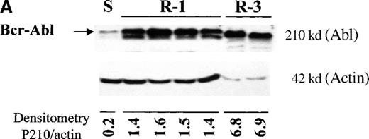 Fig. 4. BCR-ABL expression in Baf/BCR-ABL clones. / Western blots probed with anti-Abl (upper part of the filters) and anti-actin (lower part of the filters) antibodies. (A) Lane 1: Baf/BCR-ABL-s. Lanes 2-5: 4 Baf/BCR-ABL clones resistant to 1 μmol/L STI571. Lanes 6, 7: 2 Baf/BCR-ABLclones resistant to 3 μmol/L STI571. Note that one tenth the protein was loaded onto the latter 2 lanes to enable resolution of the 210-kd Bcr-Abl band without saturation of the image. Densitometric Bcr-Abl/actin ratio for each sample showed an average 7-fold Bcr-Abl overexpression in the clones resistant to 1 μmol/L STI571 and 34-fold in those resistant to 3 μmol/L in comparison with the level of expression in the sensitive parental line. (B) Modulation of Bcr-Abl expression in Baf/BCR-ABL cells grown for 3 days in the presence (+) or absence (−) of IL-3, STI571, or both. The P210/actin ratios indicate that the removal of STI571 leads to a weak reduction in the level of Bcr-Abl protein and that the effect is significantly enhanced by the addition of IL-3. These results were reproduced in 4 identical experiments. (C) BCR-ABL mRNA levels in Baf/BCR-ABL-r1 cells after 3- and 7-day withdrawal of STI571 from the culture.