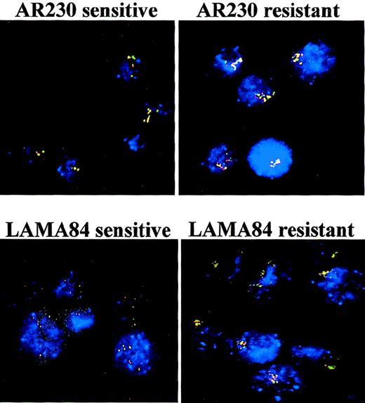 Fig. 7. FISH analysis of AR230 and LAMA84 sensitive and resistant clones, with probes for the ABL (red signal) and theBCR (green signal) genes. / BCR-ABL is identified as a red–green or yellow fused signal.