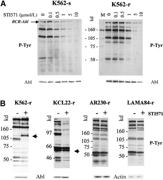 Fig. 8. Phosphotyrosine immunoblots and control staining of the same blots (after strip-washes) with anti-Abl or anti-actin antibodies. / (A) K562-sensitive and -resistant clones after a 2-hour incubation with graded concentrations of STI751. (B) K562-, KCL22-, AR230-, and LAMA84-resistant sublines incubated for 8 days in the presence (+) or absence (−) of 1 μmol/L STI571. The arrows indicate protein bands of approximately 110 and 55 to 58 kd, which become or remain hyperphosphorylated in K562-r and KCL22-r, respectively.
