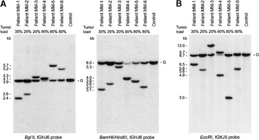 Fig. 1. IGH and IGK gene configuration of 6 IgH−/Igκ+ MM patients. / (A) IGHJ6 probe hybridization to BglII digests orBamHI/HindIII digests. (B) IGKJ5 probe hybridization toEcoRI digests.